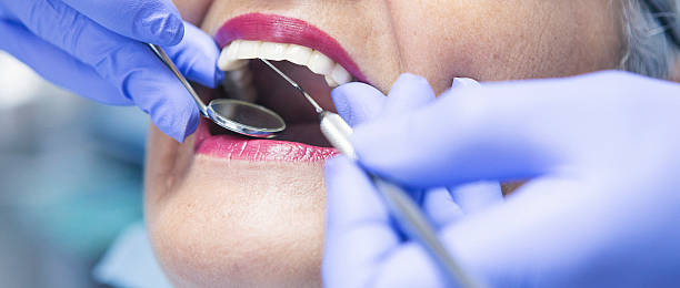 Best Cosmetic Emergency Dentistry in Squirrel Mountain Valley, CA
